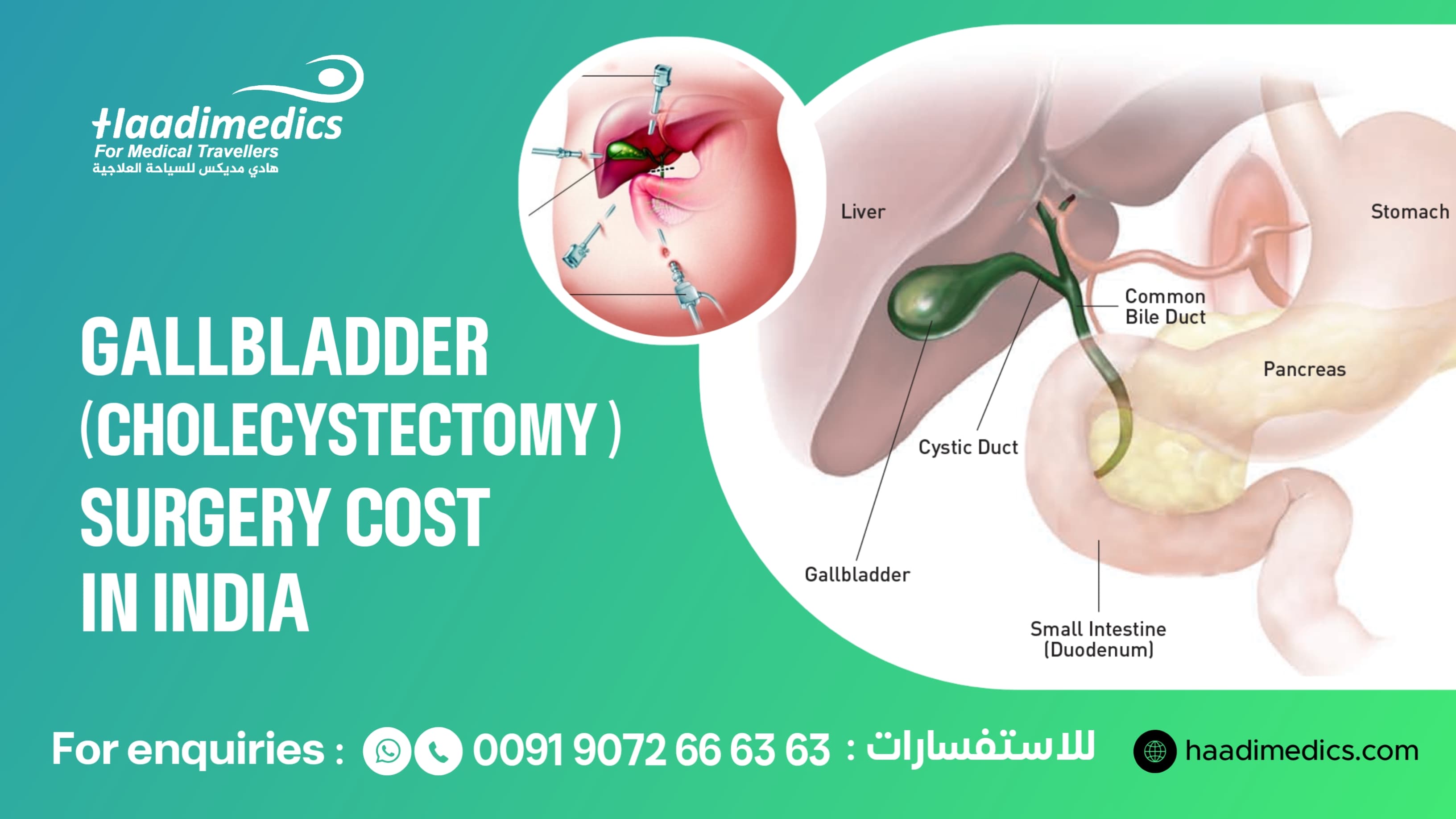 Gallbladder Surgery (Cholecystectomy) Cost in India