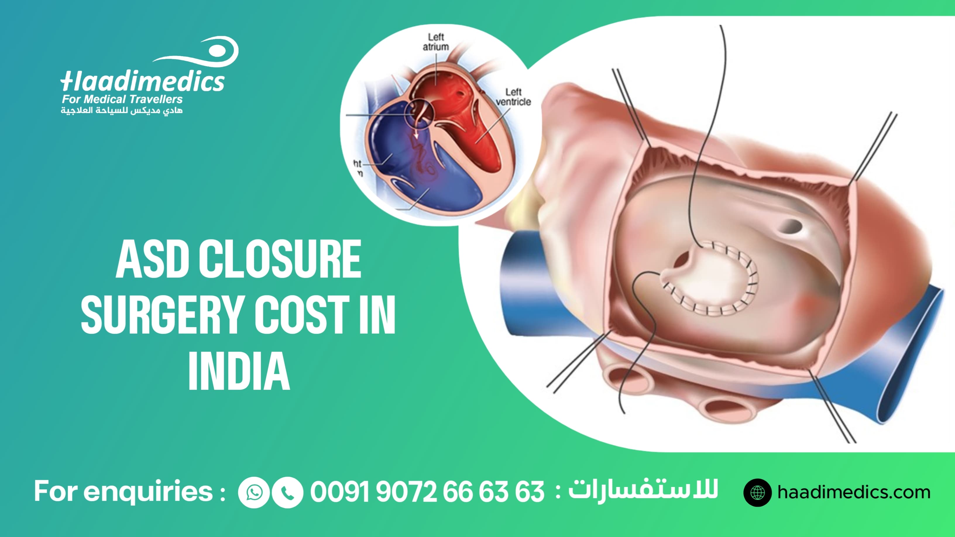 ASD Closure Surgery Cost in India