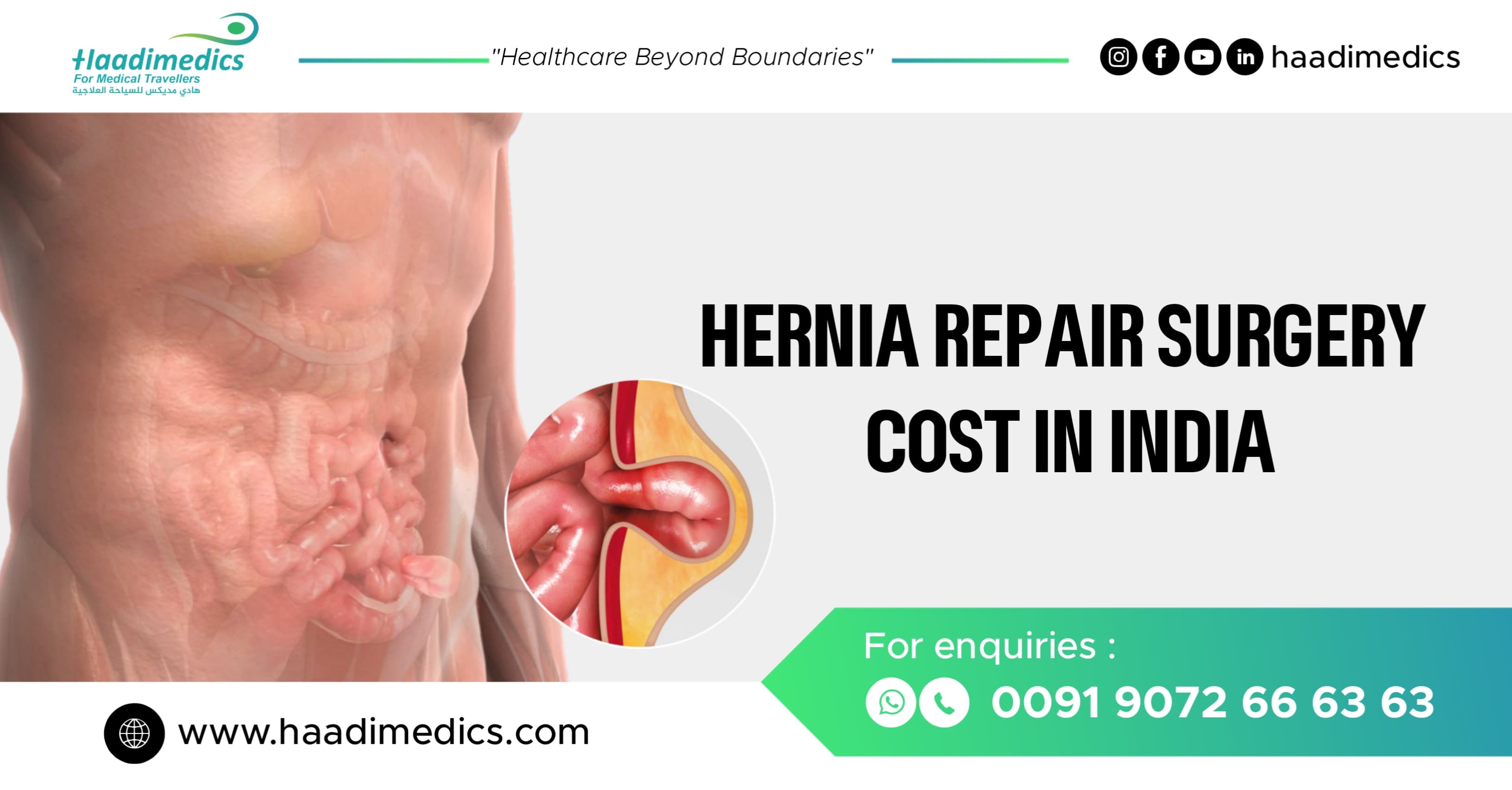 Hernia Repair Cost in India