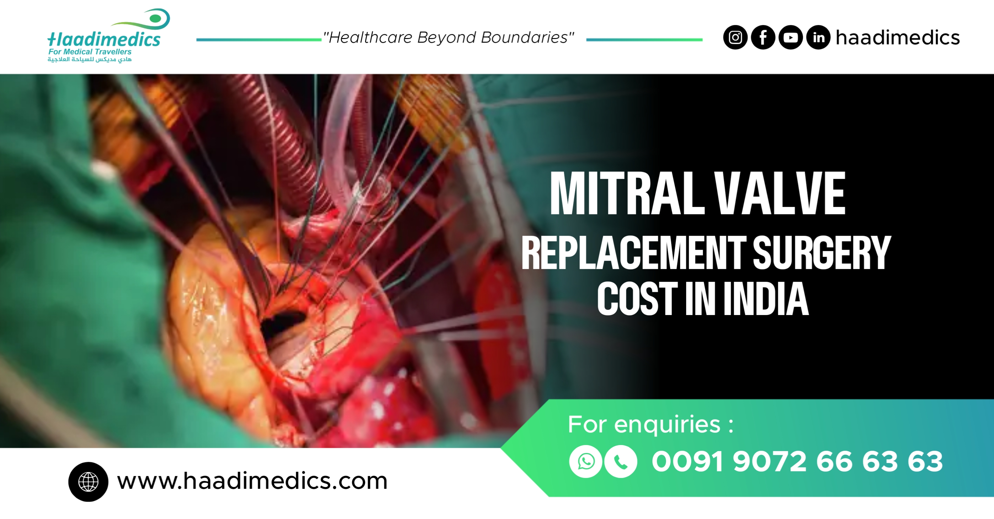 Mitral Valve Replacement Cost in India