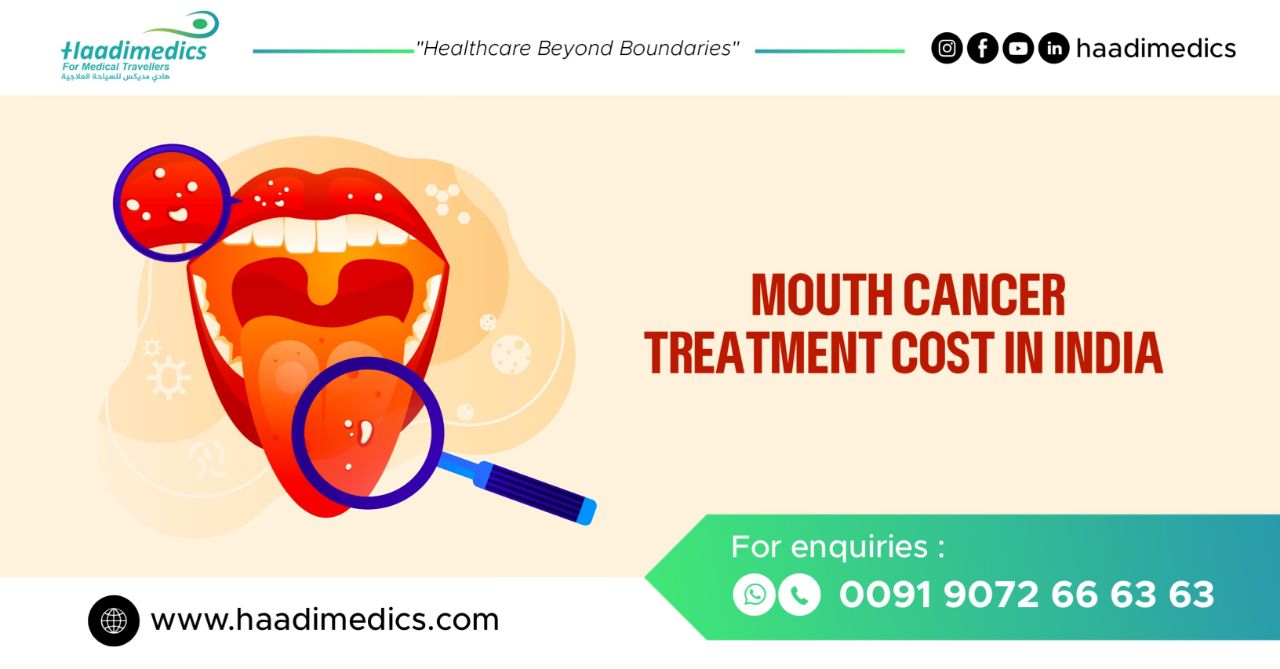 Mouth Cancer Treatment Cost in India