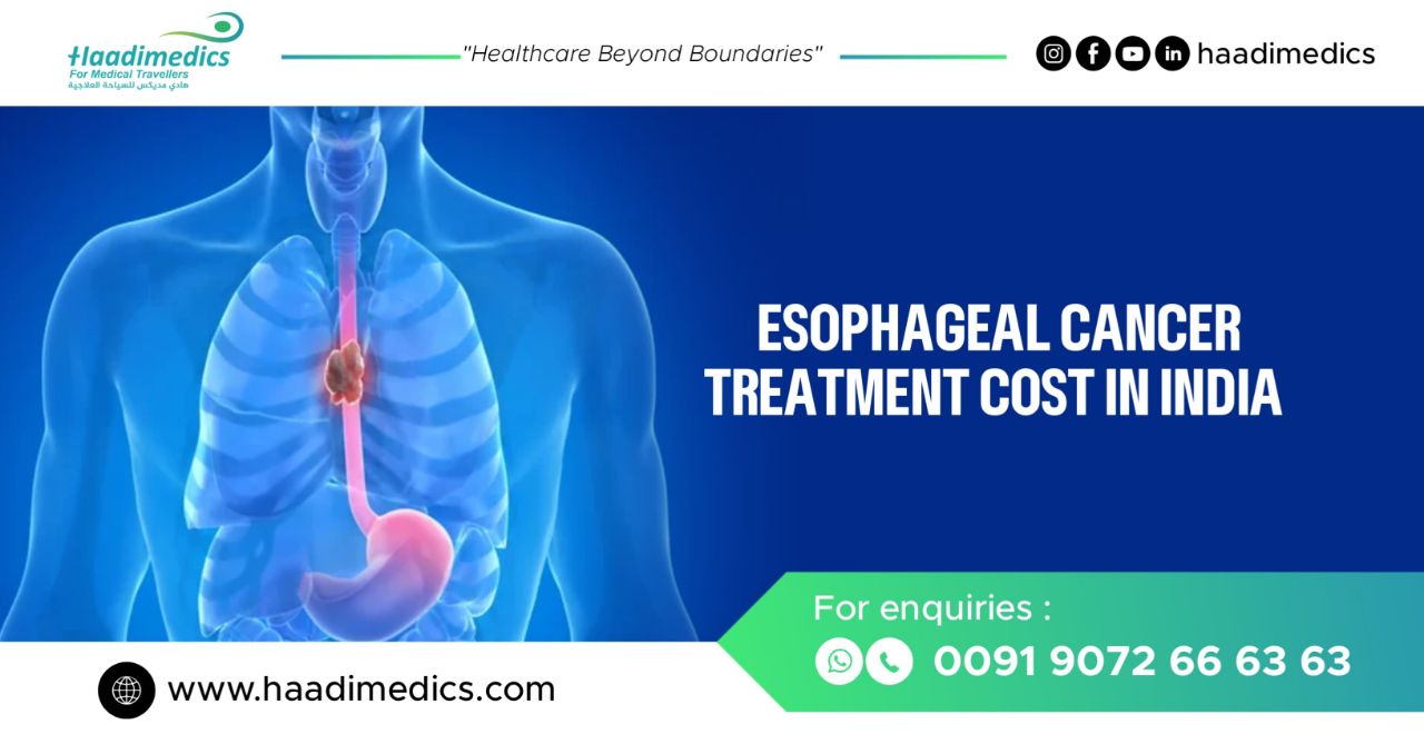 Esophageal Cancer Treatment Cost in India