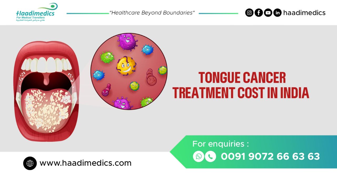 Tongue Cancer Treatment Cost in India