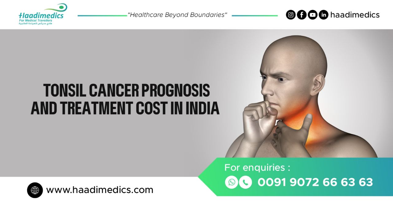 Tonsil Cancer Prognosis and Treatment Cost in India