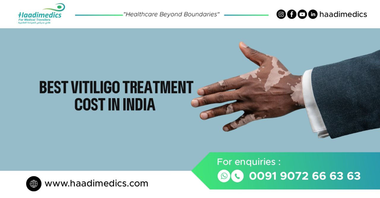 Vitiligo Treatment Cost in India