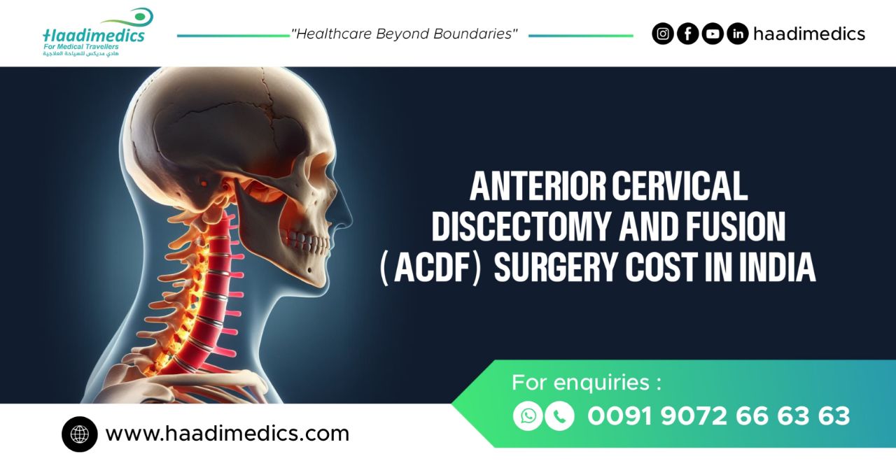 Anterior Cervical Discectomy and Fusion ‘ACDF’ Surgery Cost in India