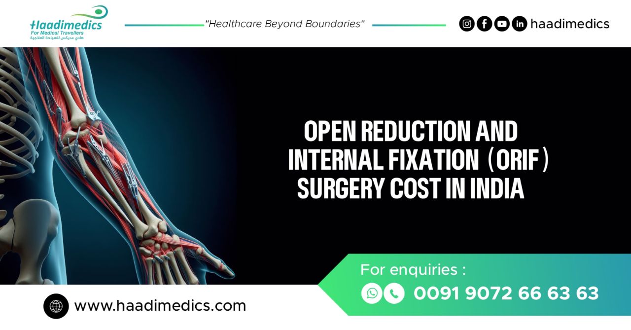 Open Reduction Internal Fixation (ORIF) Surgery Cost in India