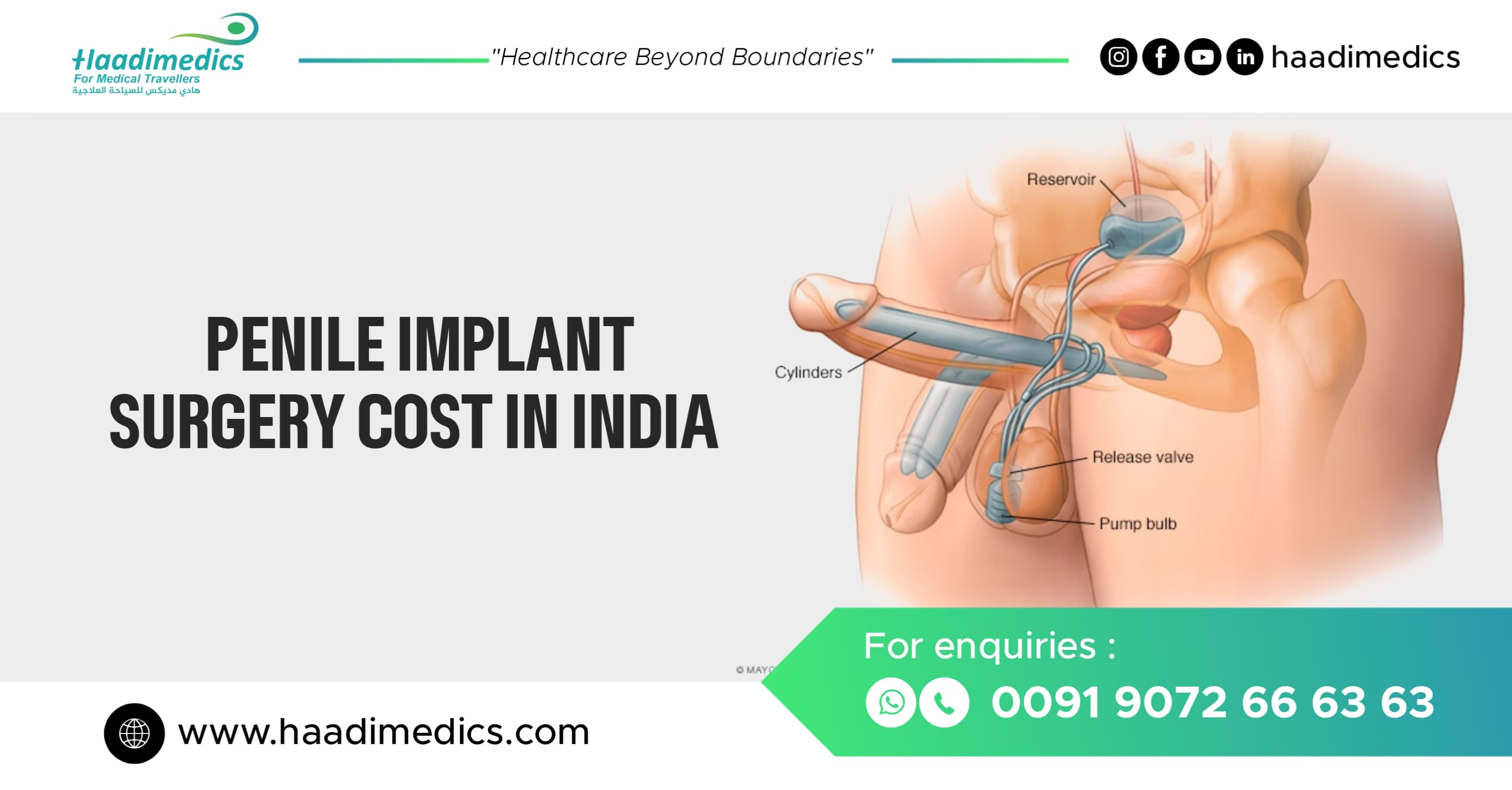 Penile Implant Surgery Cost in India