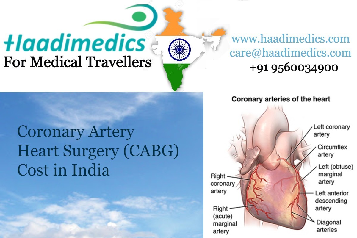 Coronary Artery Heart Surgery (CABG) Cost in India