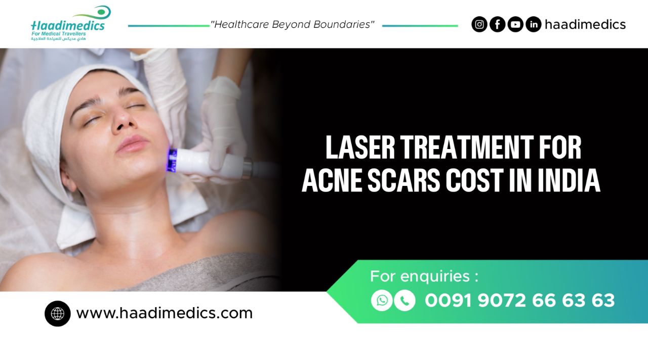 Cost of Laser Treatment for Acne Scars in India