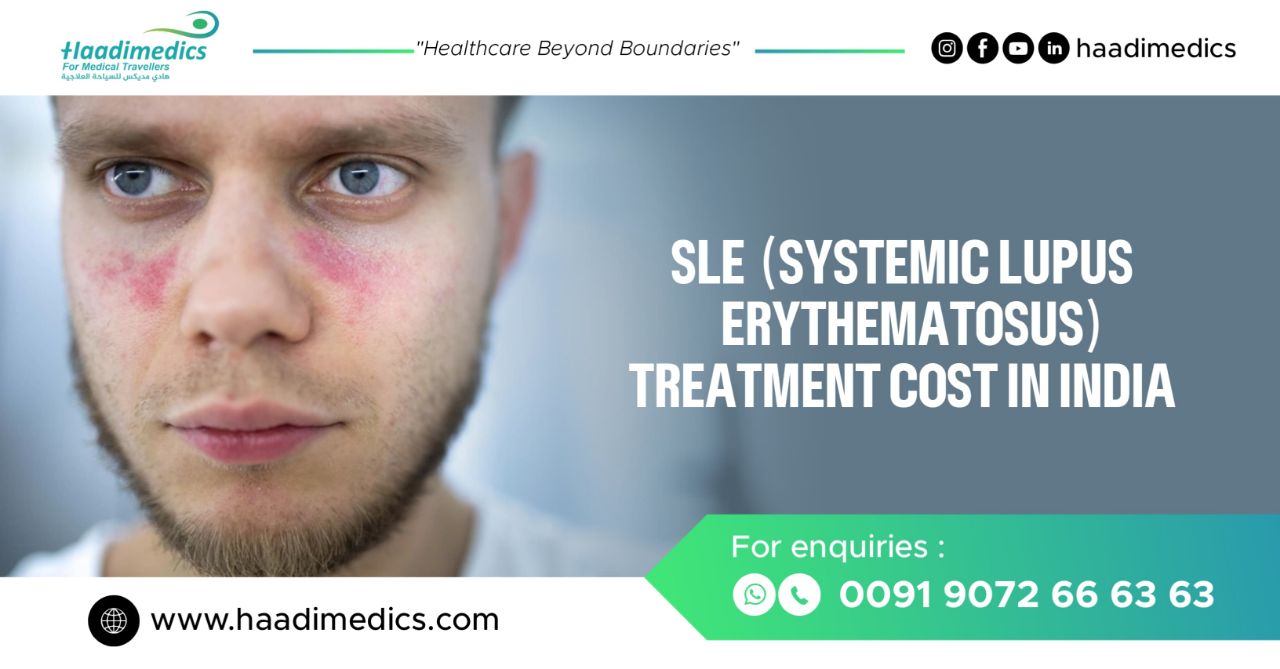 Systemic Lupus Erythematosus (SLE) Treatment Costs in India