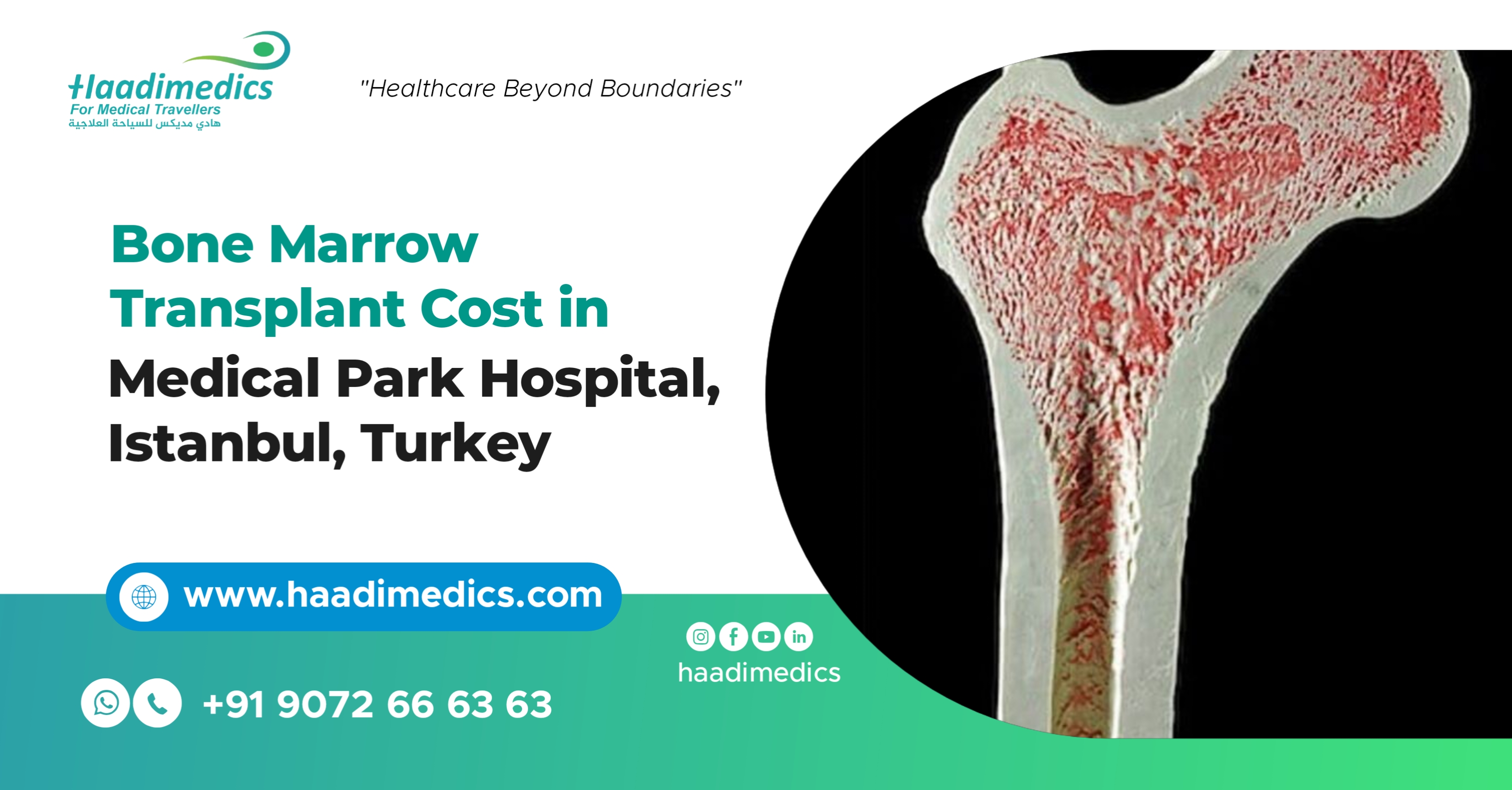 Bone Marrow Transplant Cost in Medical Park Hospital, Istanbul Turkey