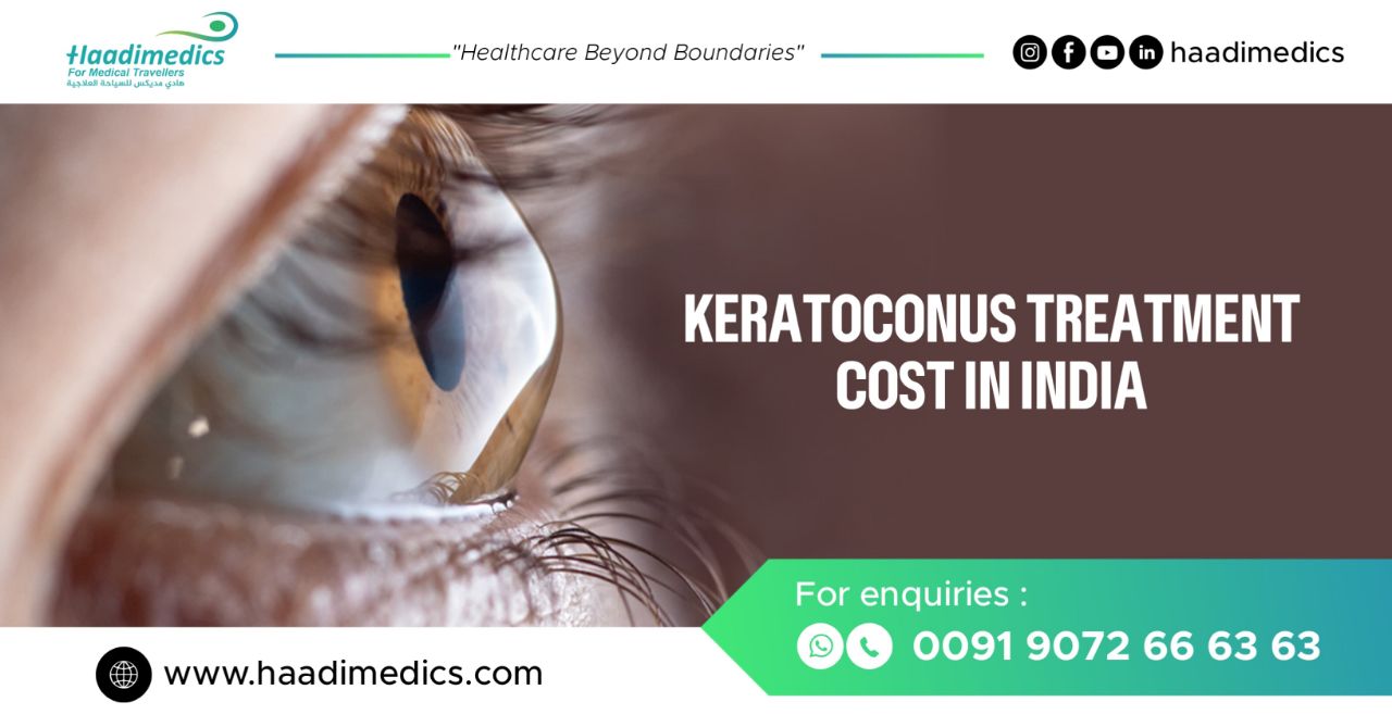 Keratoconus Treatment Cost in India