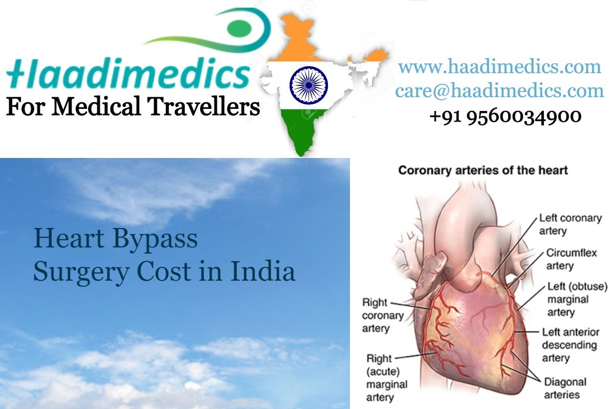 Heart Bypass Surgery Cost in India