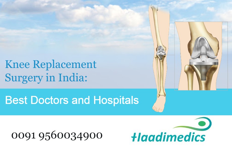 Knee Replacement Surgery in India:Best Doctors and Hospitals