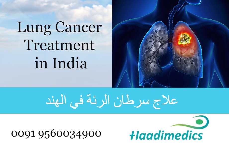 تكلفة علاج سرطان الرئة في الهند
