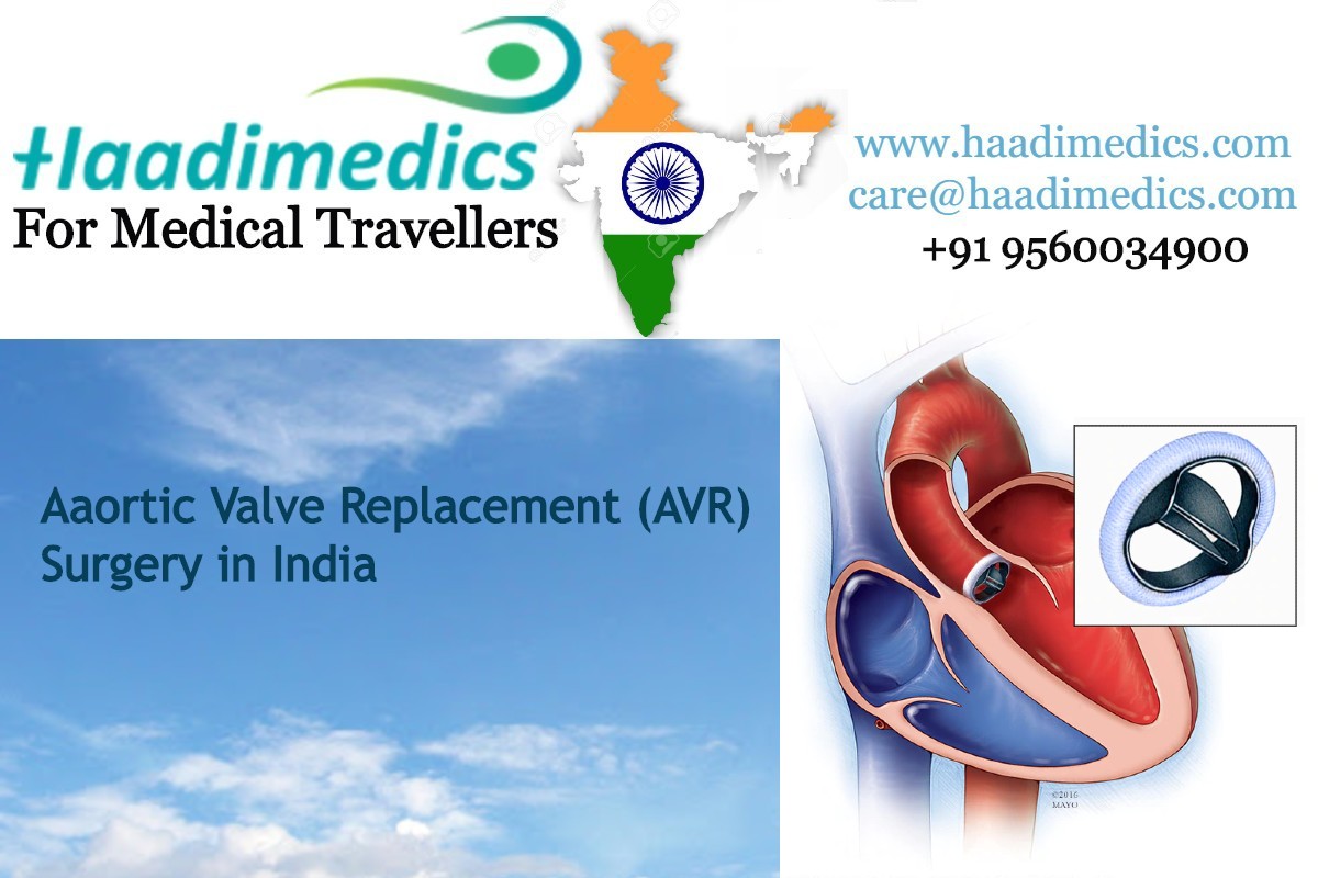 Aortic Valve Replacement in India 
