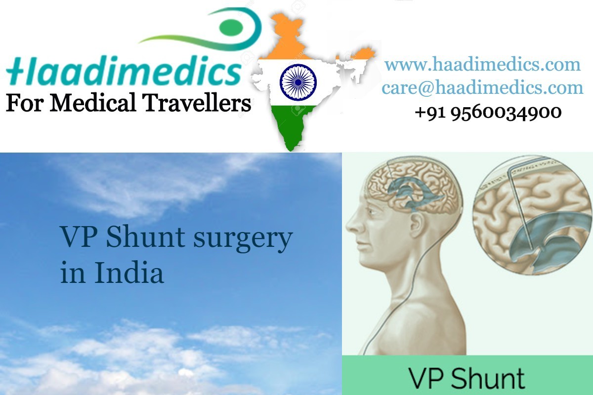 VP Shunt surgery cost in India