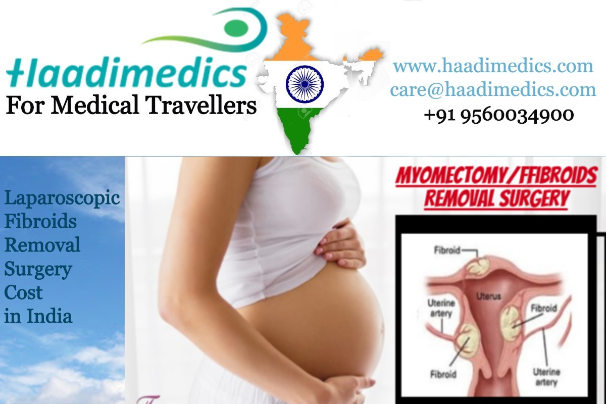 Laparoscopic Fibroid Removal Surgery Cost in India